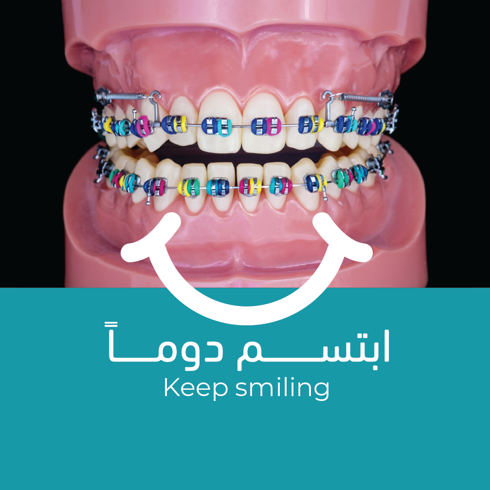 تقويم الأسنان